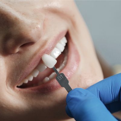 implantes